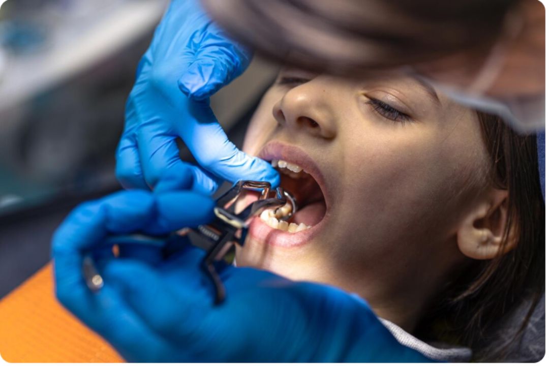 how much do metal braces cost in pune complete breakdown